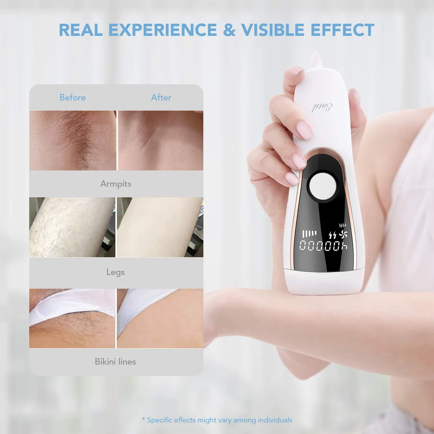 Laser Hair Removal for Women and Men, Hair Remover Permanent Painless 400,000 Flashes 2 Modes & 5 Light Intensity Settings, Whole Body Home Use